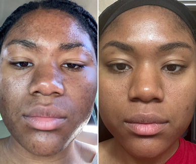 "Radiate Confidence with Luminous, Balanced Skin"